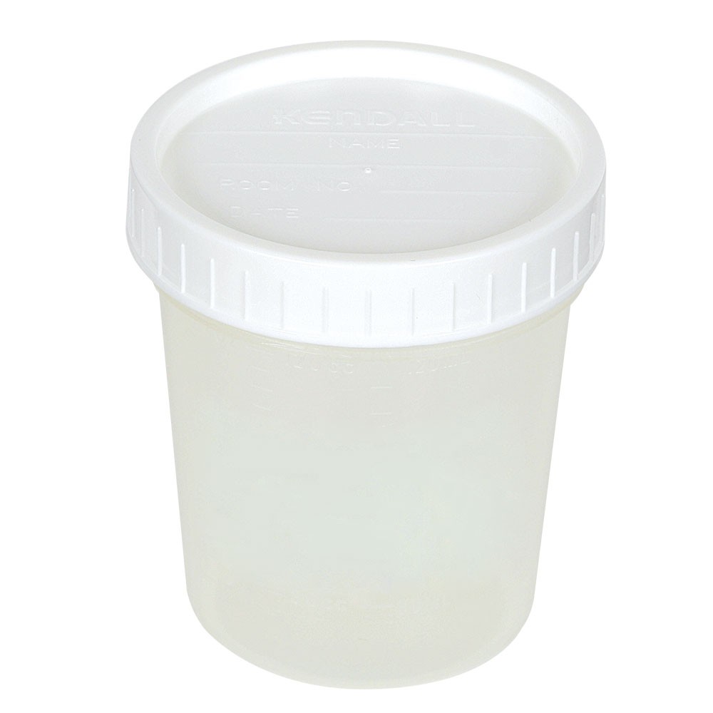 Image of cup for urine